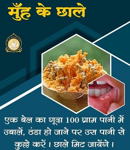 स्वास्थ्य संजीवनी: Healthy Life